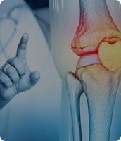 Bone & Joint Care background image